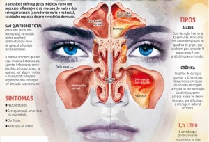 Sinusectomia_Dr_Luiz_Cantoni